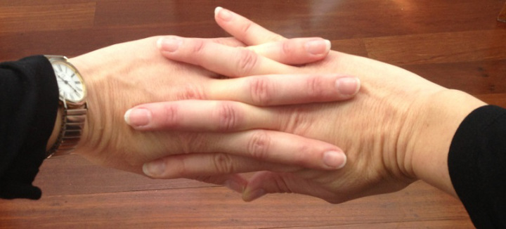 دراسة حديثة تتوصل لأسباب طقطقة الأصابع ودلالاتها