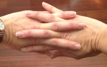 دراسة حديثة تتوصل لأسباب طقطقة الأصابع ودلالاتها